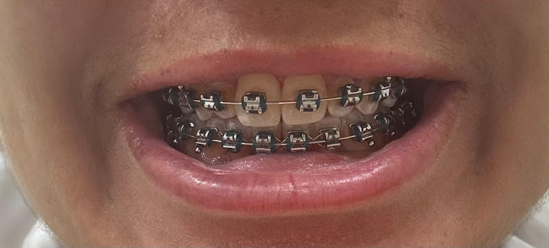 Foto 2 de GP DENTAL CLINIC - Dra. Graziela Prin