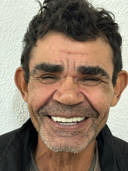 Foto 3 de Gran Clin | ClÍnica Odontológica - Facetas de Porcelana e Implantes