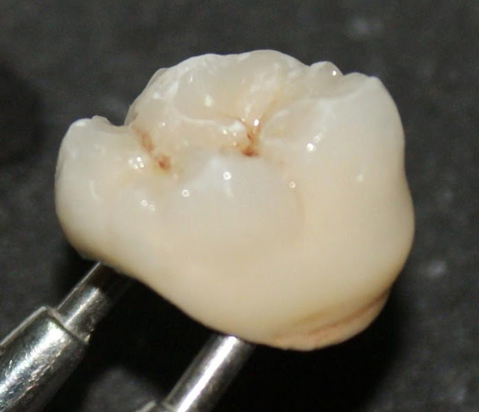 Foto 3 de GRAND Laboratório De Prótese Dental