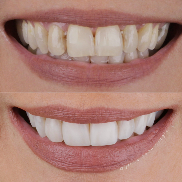 Foto 2 de Grená Odontologia Estética
