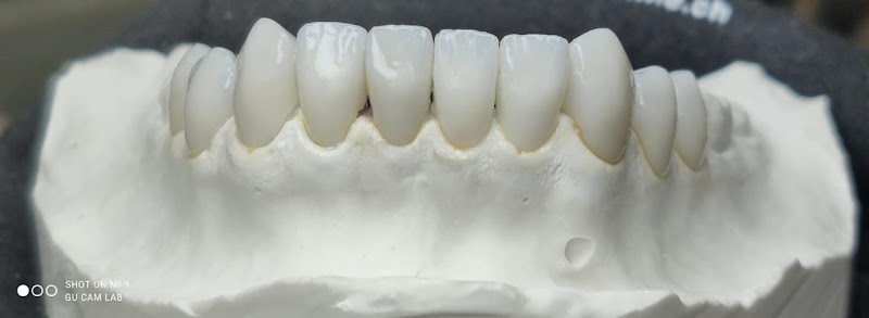 Foto 2 de Grupo Oliveira Camargo Laboratório Prótese Dentária