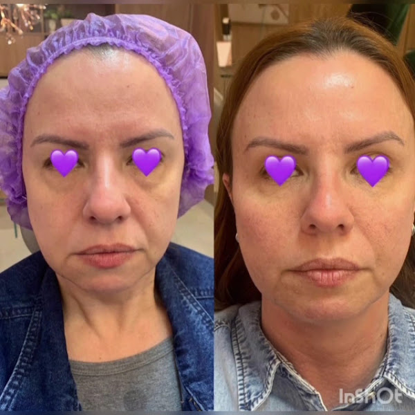Foto 3 de GS odontologia e estética