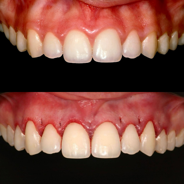 Foto 3 de Guilherme Carvalho - Periodontia