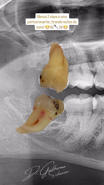 Foto de Guilherme Scheeren - Dentista