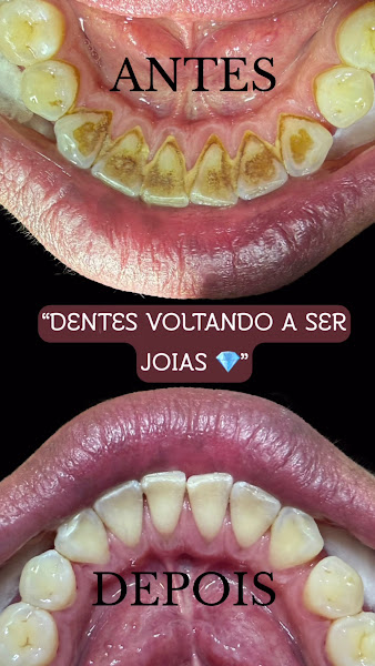 Foto 3 de Guilherme Scheeren - Dentista