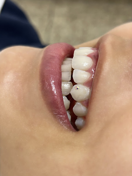 Foto 2 de GW Sorriso & Estética Dra Gabrielly Alves e Dra Vanessa Lima