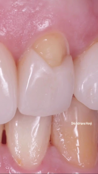 Foto 4 de Hale Clinic | Dentista no Itaim Bibi | Invisalign, Facetas e Implantes