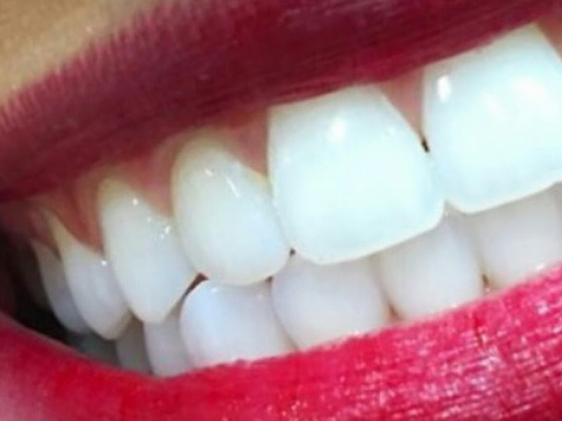 Foto 3 de Halitose Maceió