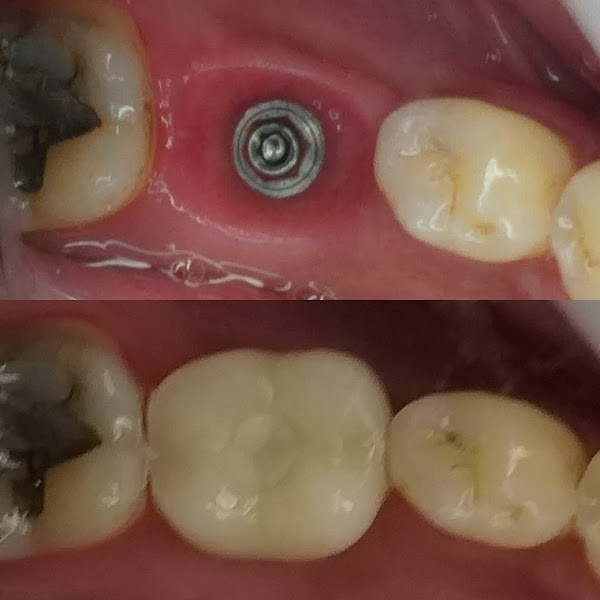 Foto 3 de Hamasaki Odontologia - Estética dental