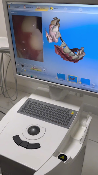 Foto 4 de Hamata Odontologia | Implante Dentário | Dentista Vila Clementino São Paulo