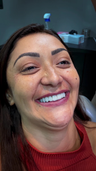 Foto 2 de Hamonização Facial Boa Vista - Dr Raphá Teles