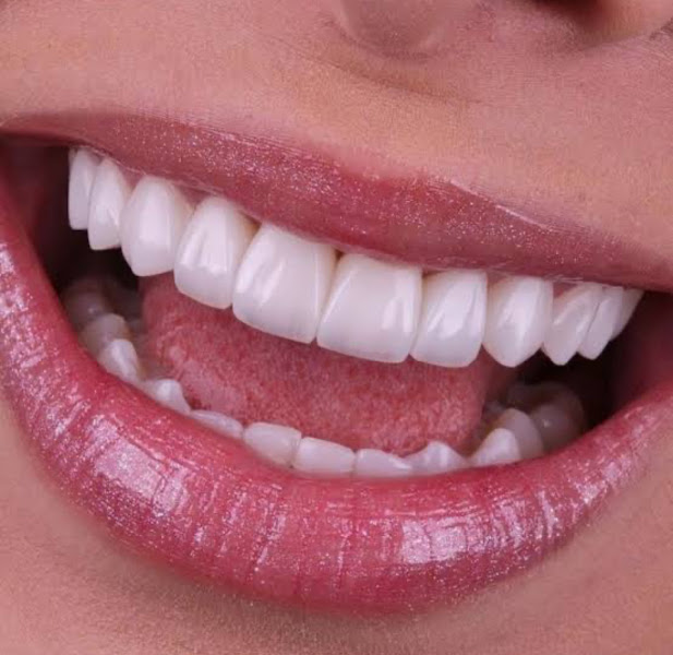Foto 2 de Happy Consultório Odontológico • Invisalign • Implante • Harmonização Facial • Dentista em Teresina