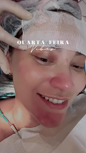 Foto 3 de Happy Consultório Odontológico • Invisalign • Implante • Harmonização Facial • Dentista em Teresina