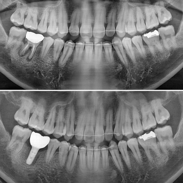 Foto 3 de Harmo Odontologia Integrada Gustavo Hoffmann Fracasso