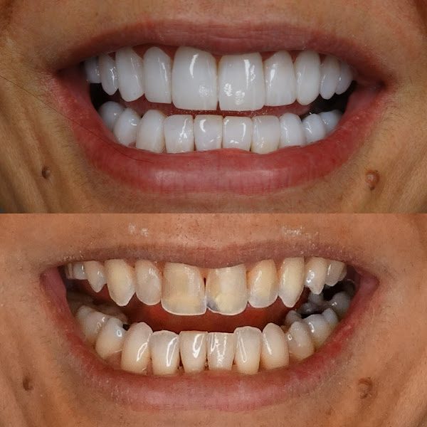 Foto 2 de HARMOMAKE | Clínica Odontológica (Facetas, Implantes e Harmonização Facial)