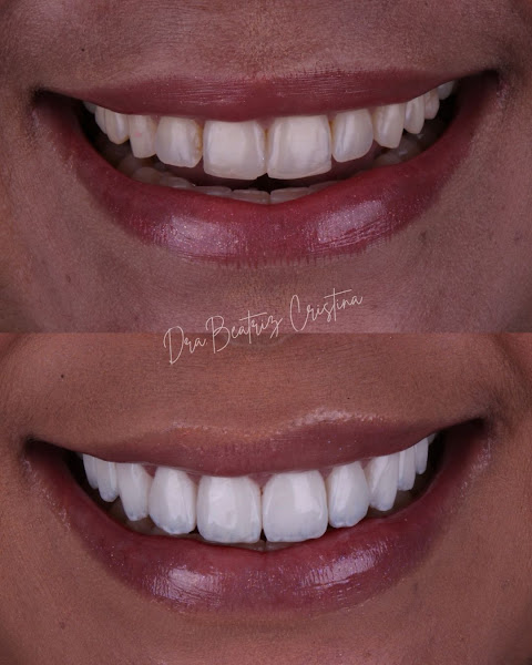 Foto 3 de HARMOMAKE | Clínica Odontológica (Facetas, Implantes e Harmonização Facial)