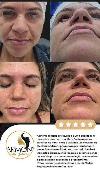 Foto 2 de HARMONIA DA FACE SG