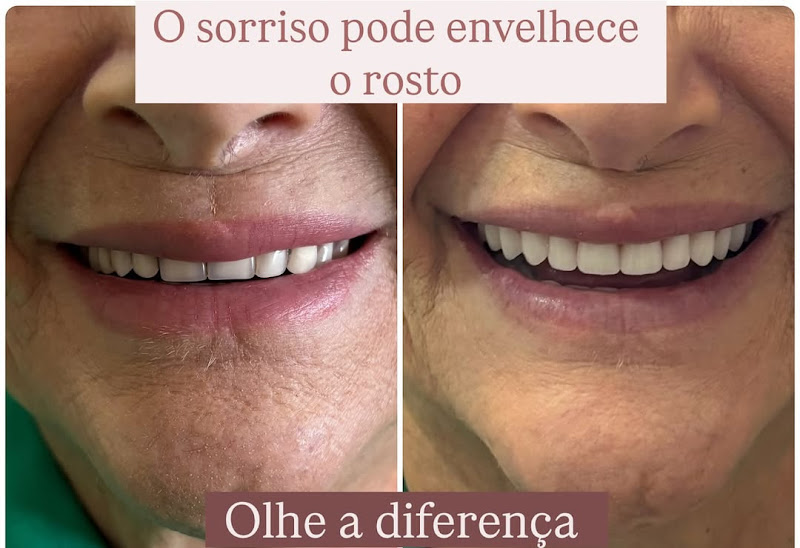 Foto 3 de Harmoniza Estética Facial e Odontológica | Campinas