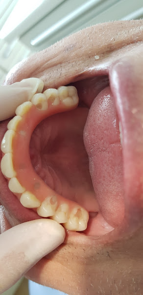 Foto 3 de Harmoniza Odontologia Reabilitação Oral e Harmonização Orofacial