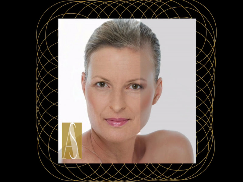 Foto de Harmonização