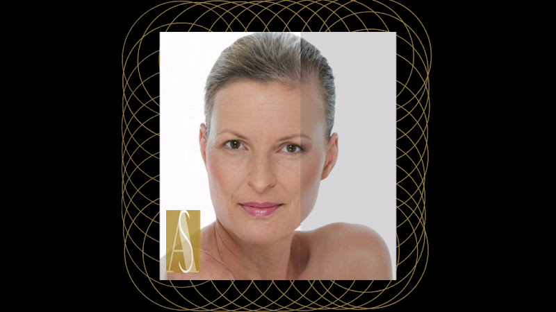 Foto 2 de Harmonização