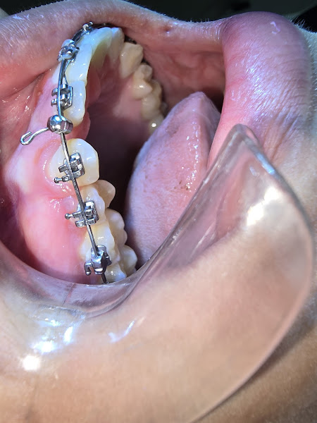 Foto 3 de Harmonização