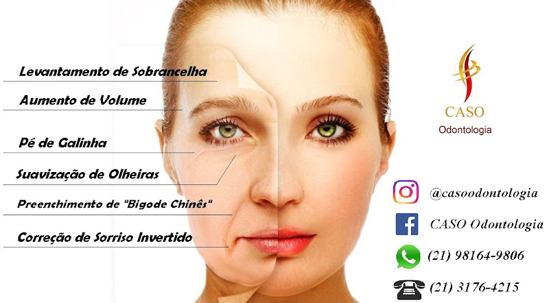 Foto 3 de Harmonização Facial - CASO Odontologia