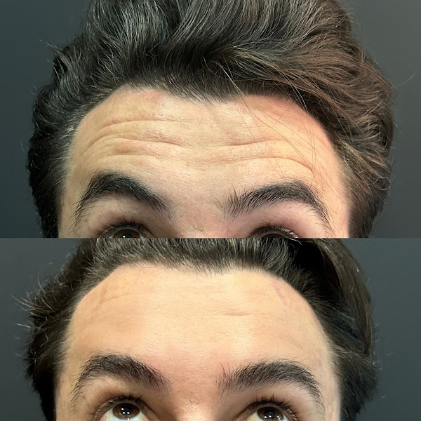 Foto 3 de Harmonização facial - Dra Franciely Lopes