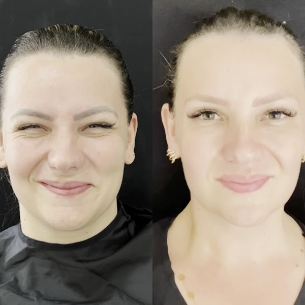 Foto 3 de Harmonização Facial | Dra. Lilian Santo | Estética Facial