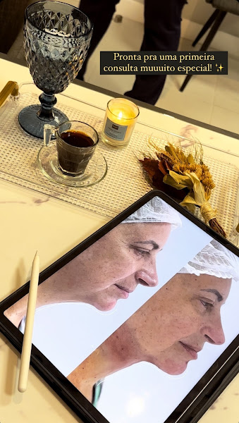 Foto 2 de Harmonização Facial Dra Miriã Bergamasco