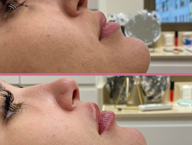 Foto 2 de Harmonização facial e Saúde Estética - Dra Juliana Cotrin