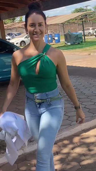 Foto 3 de Harmonização Facial Marabá Dra Simone Oliveira