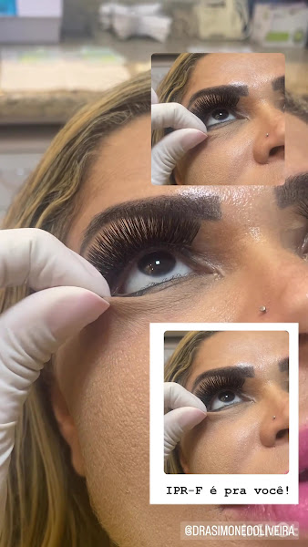 Foto 4 de Harmonização Facial Marabá Dra Simone Oliveira