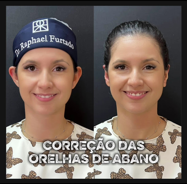 Foto 3 de Harmonização Facial RJ | Dr. Raphael Furtado