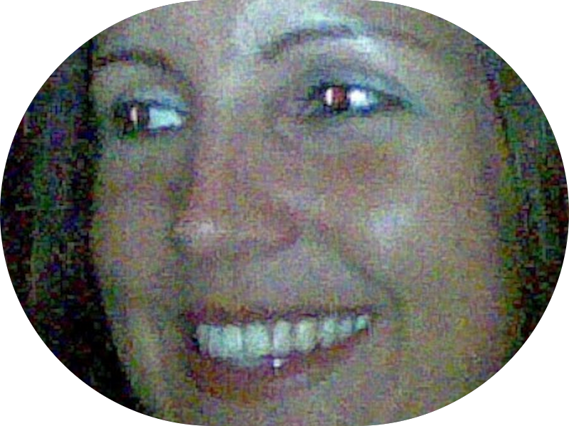 Foto 2 de Harmonização Orofacial e Ortodontia-Dra.Ana Sbrocca