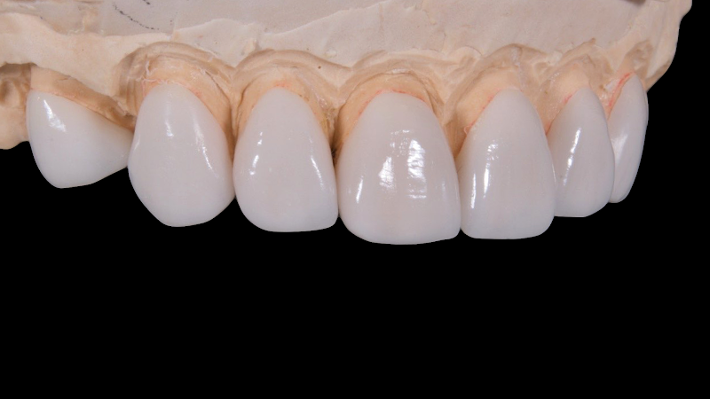 Foto 2 de HARMONIZE Odontologia e Estética Facial