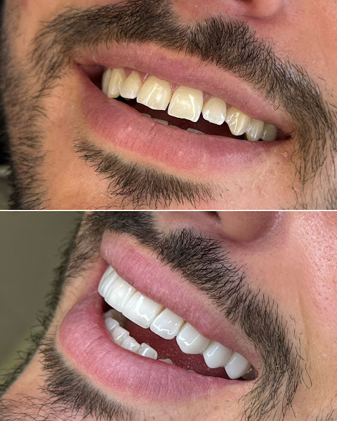 Foto 2 de Harmonize Odontologia e Estética | Referência em Harmonização Facial e Odontologia