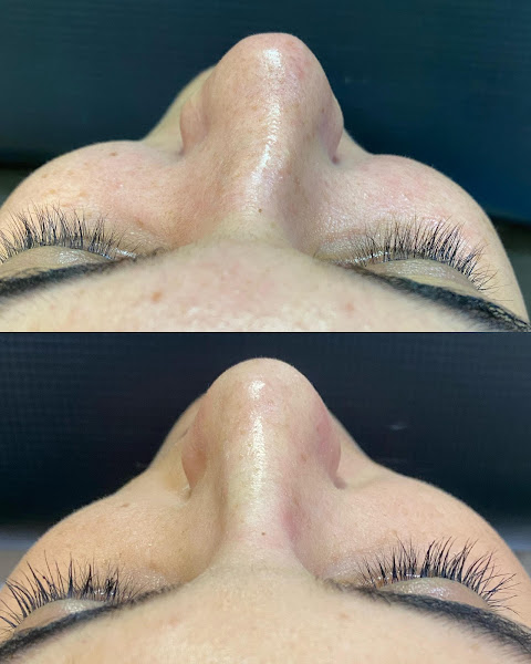 Foto 3 de Harmonize Odontologia e Estética | Referência em Harmonização Facial e Odontologia