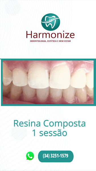 Foto 2 de Harmonize - Odontologia, Estética e Bem Estar (Dra. Karinne Almeida)