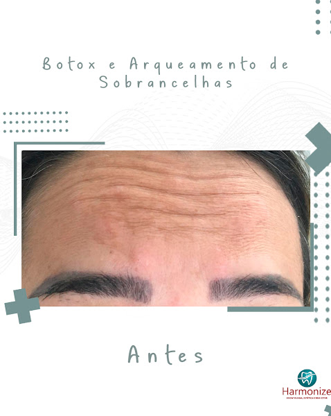 Foto 3 de Harmonize - Odontologia, Estética e Bem Estar (Dra. Karinne Almeida)