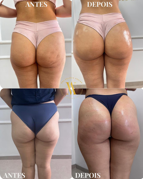 Foto 3 de Harmonize - Ozônio, Saúde e Estética