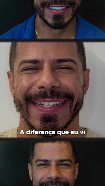 Foto 3 de Harmonize Sorriso e Face