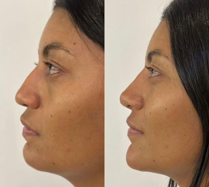 Foto 3 de Harmonizzie Estética Avançada - Clínica