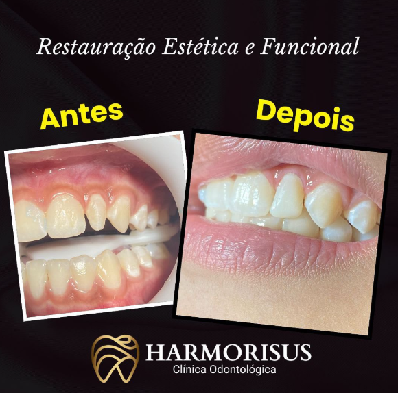 Foto 3 de Harmorisus Clínica Odontológica