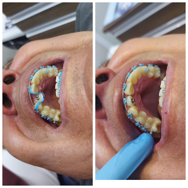 Foto 3 de Hayashi Odontologia – Implantes e Dentista em Santo André