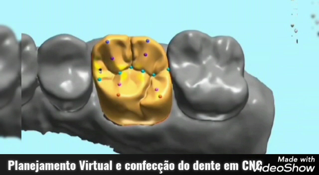 Foto 3 de HE3D Odontologia e Estética Digital