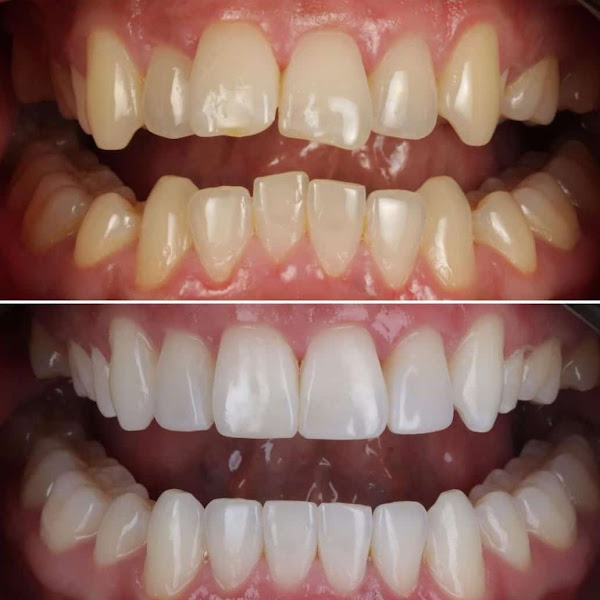 Foto 2 de Heloísa Santos - Odontologia