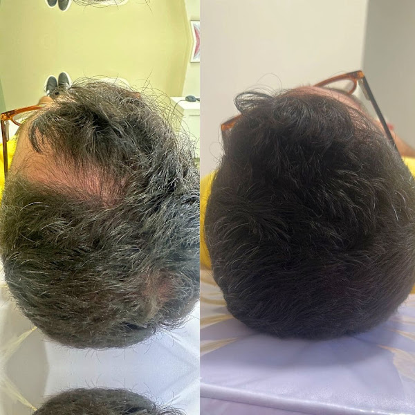 Foto 3 de Hera | Clínica de Estética Avançada em Cotia