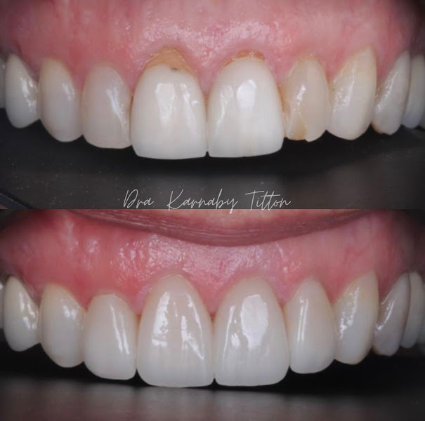 Foto 3 de Hetessy Odontologia