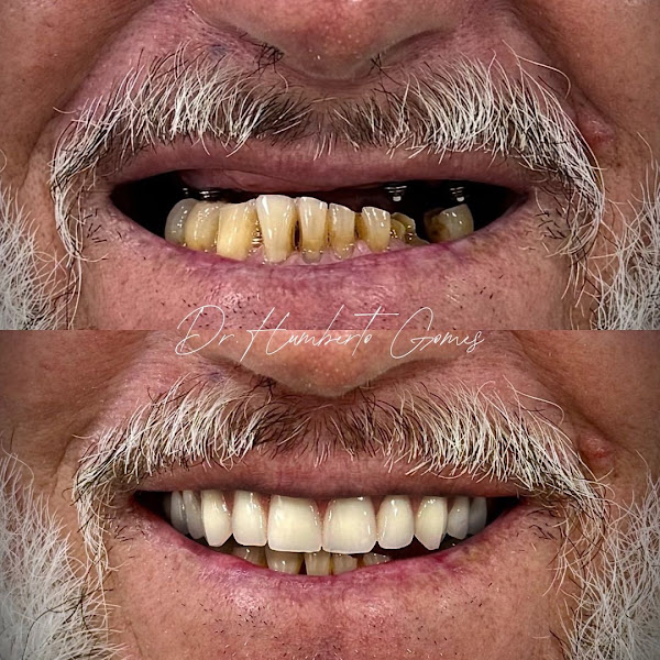 Foto 2 de HG Dental – Implantes e Estética